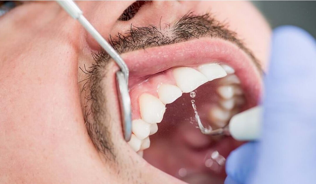 हिरड्यांची काळजी घेणारी शाखा Periodontology