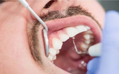 हिरड्यांची काळजी घेणारी शाखा Periodontology